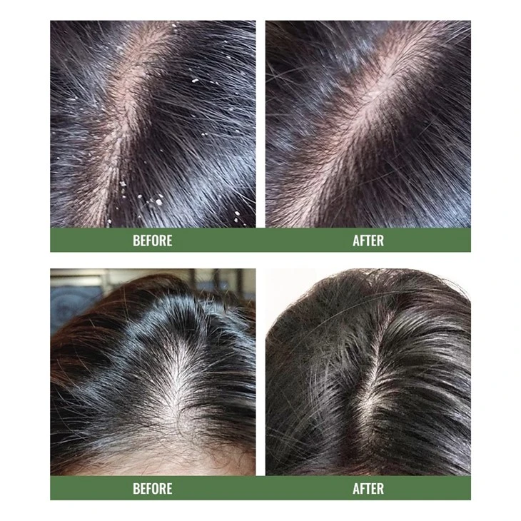 Tea Tree Shampoo